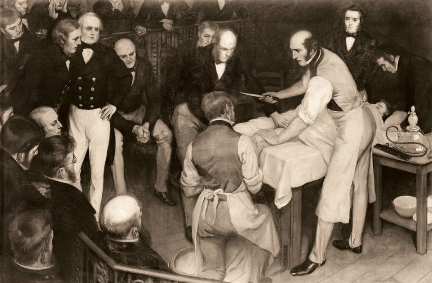 Тайны истории: 10 шокирующих фактов о викторианской хирургии