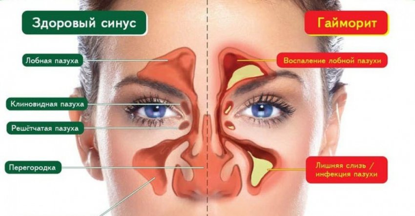 Выведи СЛИЗЬ из организма и омолодись на 10 лет!