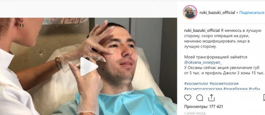 Кирилл «Руки-базуки» сделал пластику лица, чтобы стать похожим на Анджелину Джоли