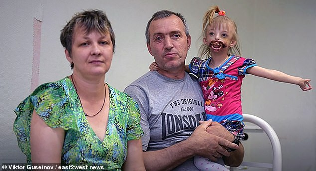 «Когда я увидела ее, то упала в обморок»: Лондонские хирурги сделают российской девочке новое лицо - Паранормальные новости «Когда я увидела ее, то упала в обморок»: Лондонские хирурги сделают российской девочке новое лицо - Паранормальные новости