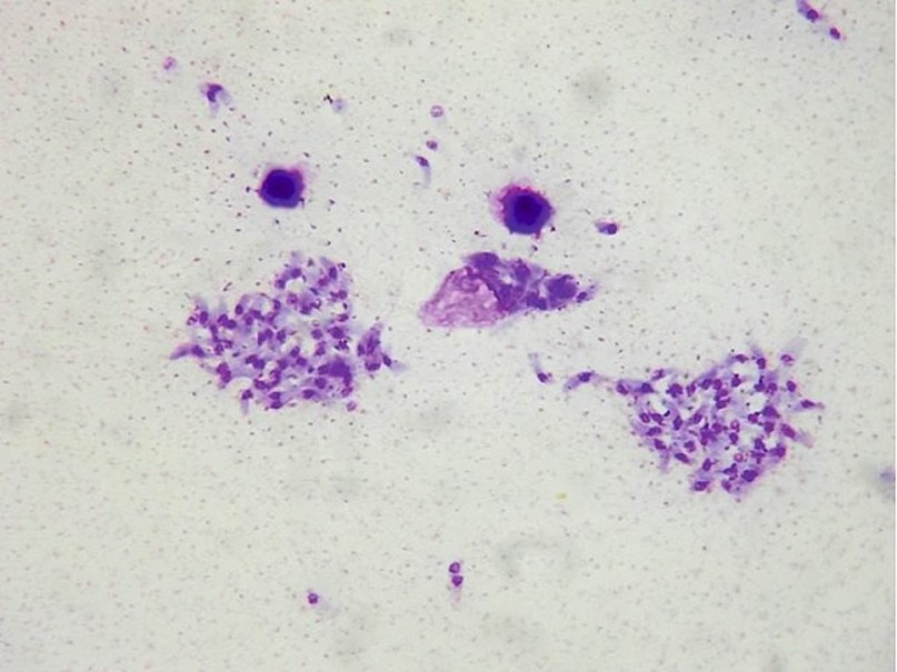 Мозговые захватчики: размножение идейных паразитов Мозговые захватчики: размножение идейных паразитов