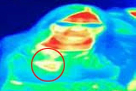 Женщина сходила на выставку и выявила там у себя рак