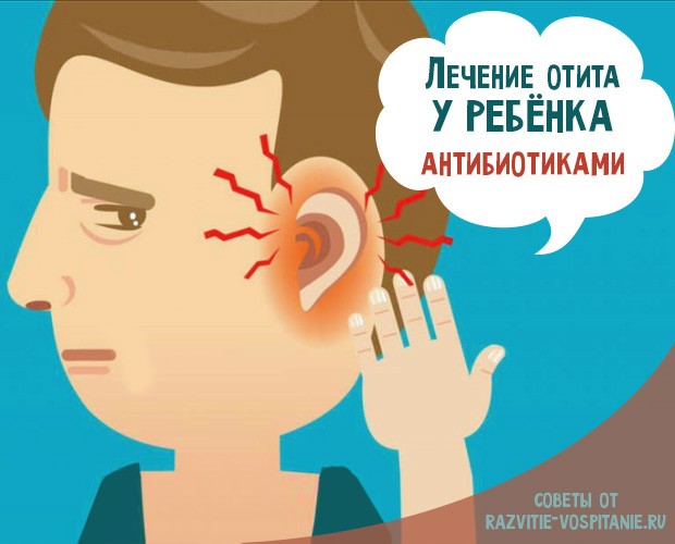 Антибиотики при отите у детей: 3 группы эффективных препаратов Антибиотики при отите у детей: 3 группы эффективных препаратов