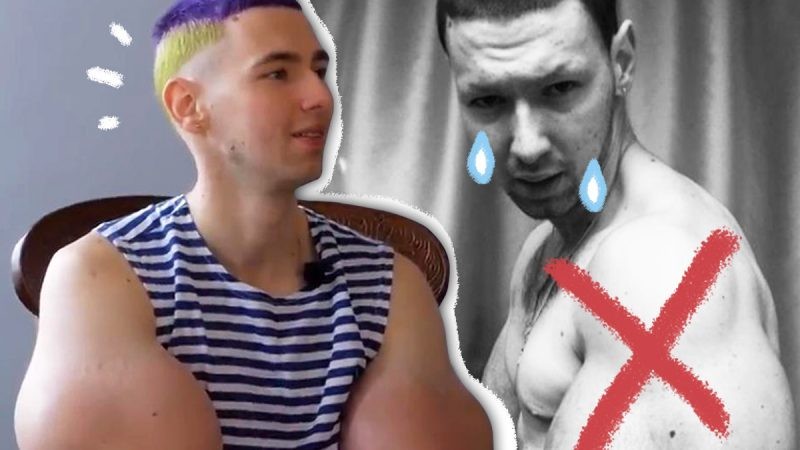 По последним новостям Кирилл Терешин сделал операцию на «руках-базуках»