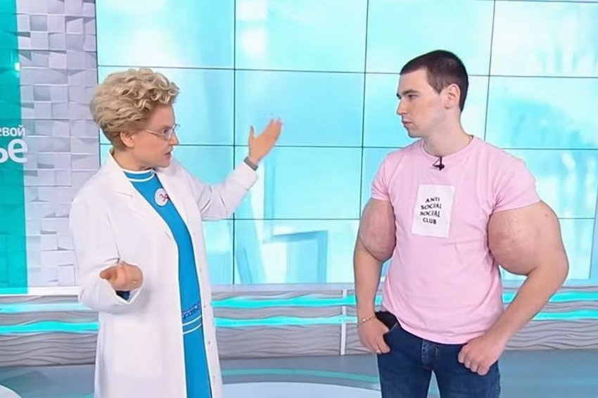 По последним новостям Кирилл Терешин сделал операцию на «руках-базуках»