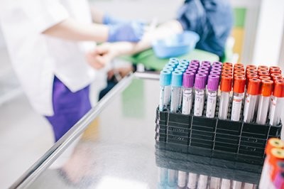 Врач-инфекционист назвала 10 анализов, на которые не стоит тратить деньги Врач-инфекционист назвала 10 анализов, на которые не стоит тратить деньги