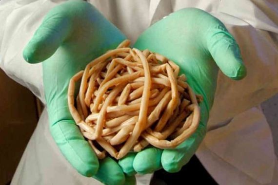 Названы продукты, которые способны уничтожить паразитов