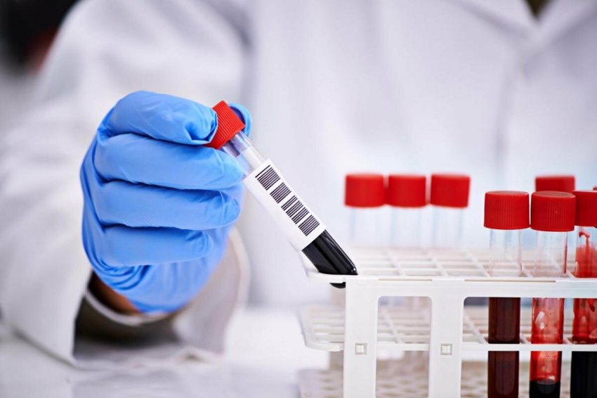 В Германии довольны улучшением эпидемиологической ситуации в июне 2021 года